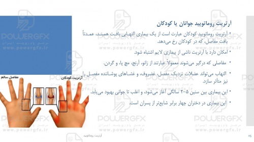 slide15_906262255